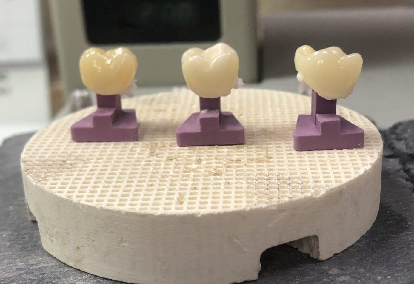 Perfect Pegs Ceramic Firing Pegs Dental Creations, Ltd.