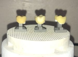Dental Creations Ltd - Perfect Pegs - Immediately Out of Oven