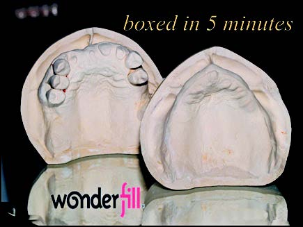 Dental Creations, Ltd - Wonderfill Boxed in 5 Minutes