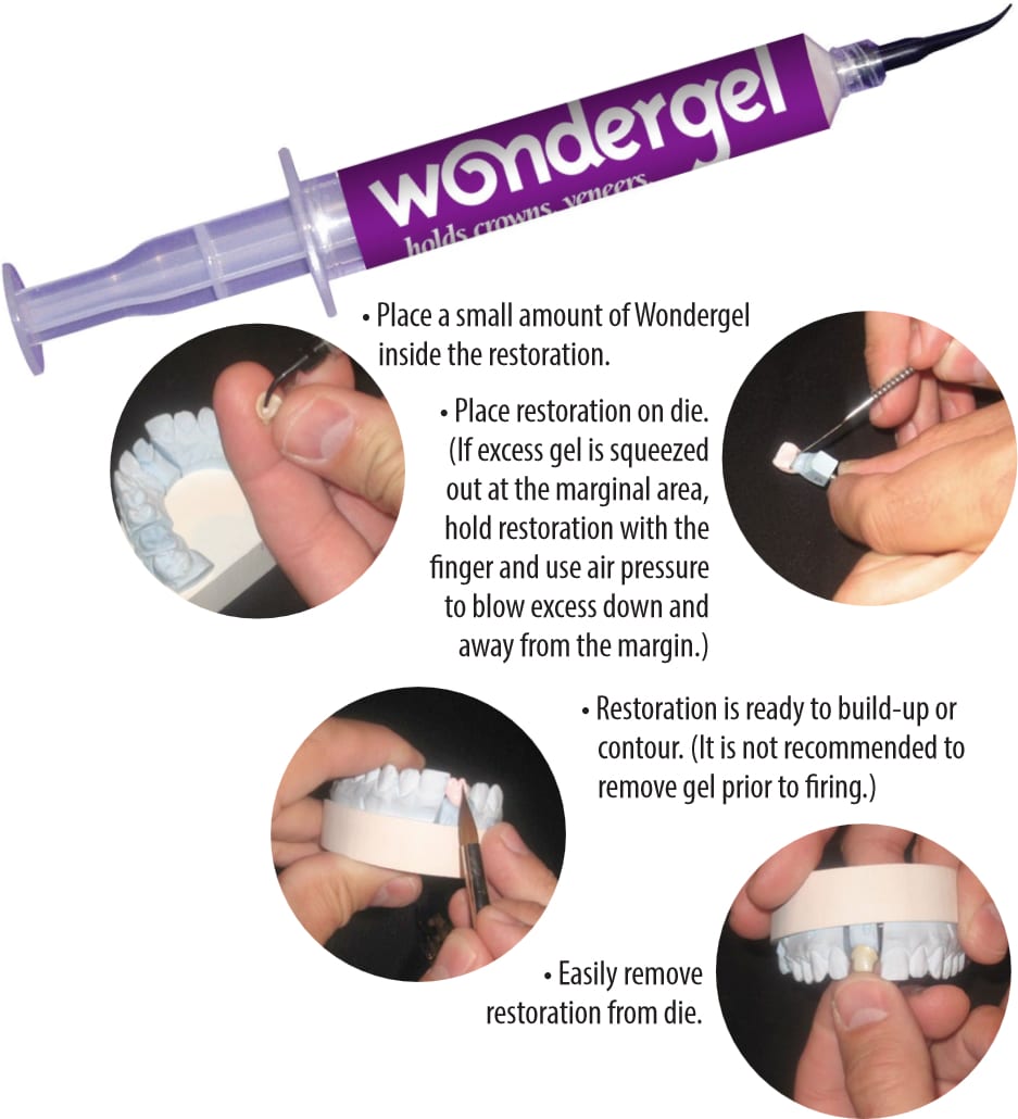 Dental Creations LTD - Wondergel Technical Article